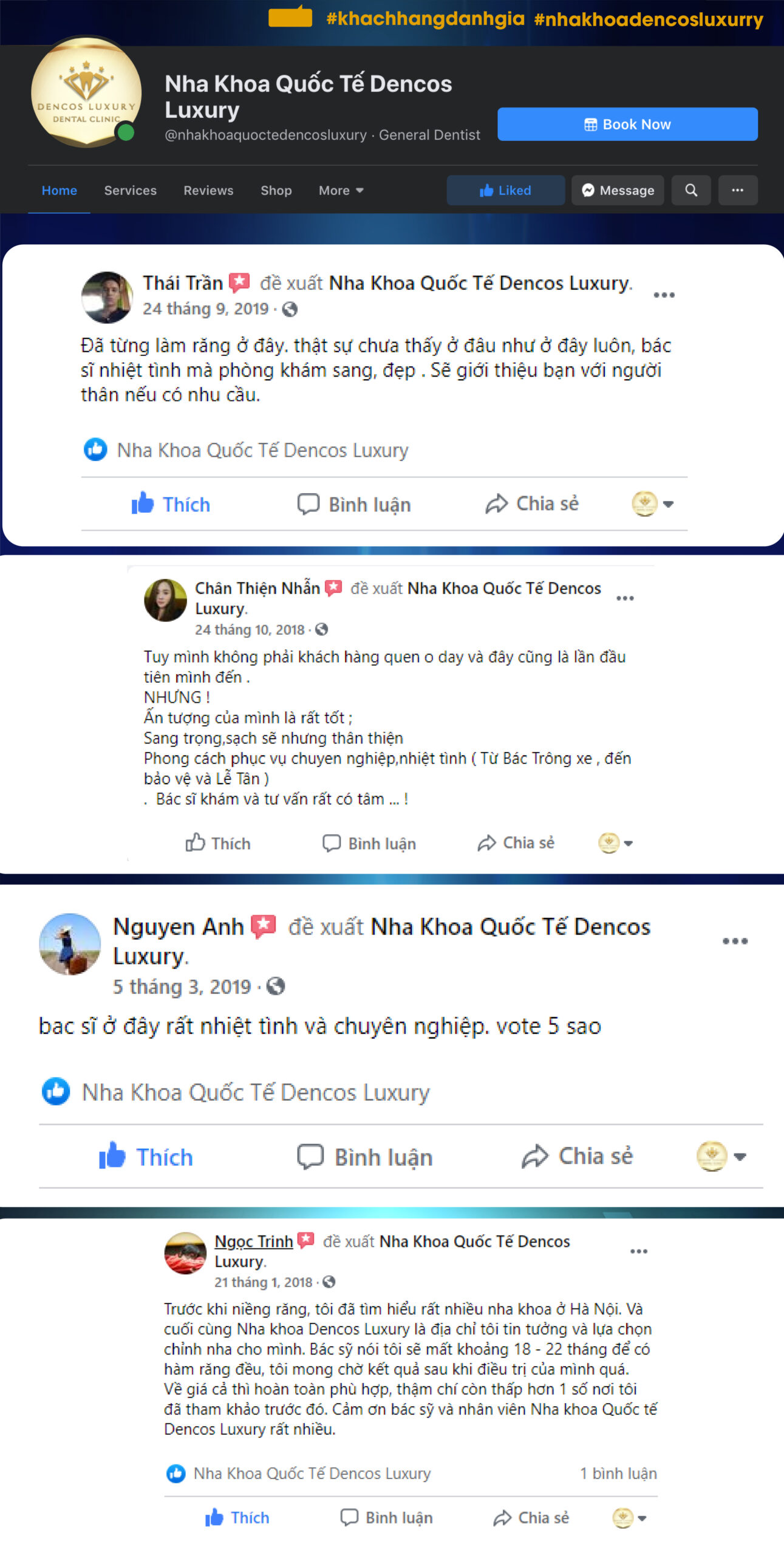 review niềng răng
