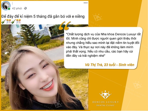 review niềng răng