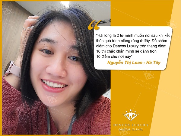 review niềng răng