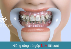 NIỀNG RĂNG DỊCH CHUYỂN RĂNG NHƯ THẾ NÀO?