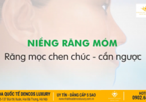 NIỀNG RĂNG MÓM ĐƯỢC THỰC HIỆN NHƯ THẾ NÀO?