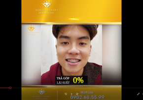 TỔNG HỢP CÁC KHÁCH HÀNG ĐÃ NIỀNG RĂNG TẠI DENCOS LUXURY