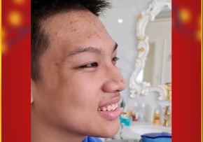 THÁO MẮC CÀI CHO CHÀNG TRAI XỨ THANH 16 TUỔI – KẾT QUẢ VƯỢT MONG ĐỢI