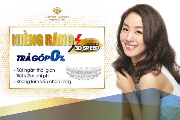 niềng răng mắc cài công nghệ 3D Speed