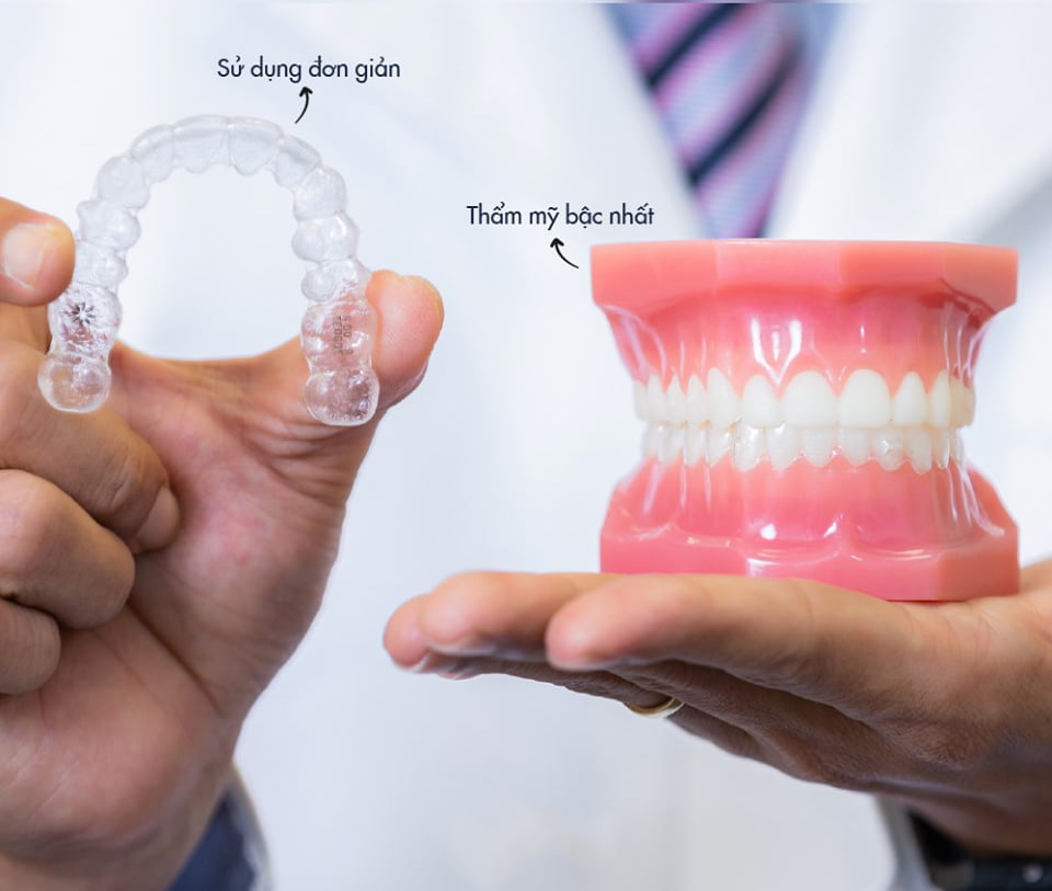 niềng răng invisalign